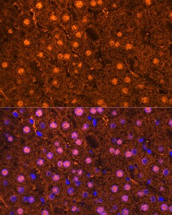 ABclonal Technology Arginase 1 (ARG1) Rabbit mAb 100 L, Quantity: Each