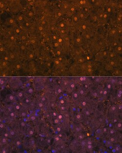 ABclonal Technology Arginase 1 (ARG1) Rabbit mAb 100 L, Quantity: Each