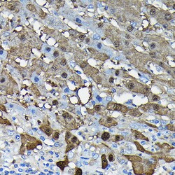 ABclonal Technology Arginase 1 (ARG1) Rabbit mAb 100 L, Quantity: Each