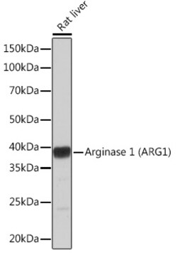 ABclonal Technology Arginase 1 (ARG1) Rabbit mAb 100 L, Quantity: Each