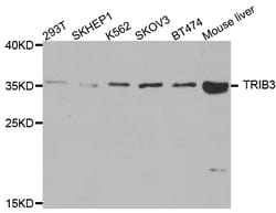 ABclonal Technology TRIB3 Polyclonal Antibody, 100UL, Validated in:WB,