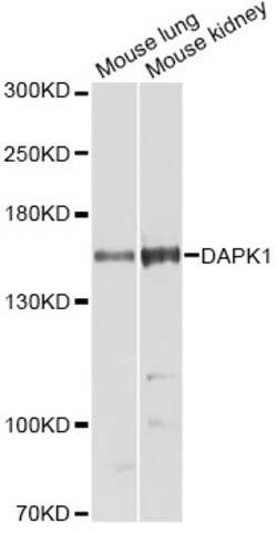 ABclonal Technology DAPK1 Polyclonal Antibody, 100UL, Validated in:WB,