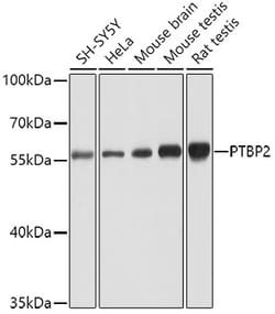 ABclonal Technology PTBP2 Polyclonal Antibody, 100UL, Validated in:WB,