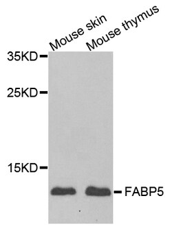 ABclonal Technology FABP5 Polyclonal Antibody, 100UL, Validated in:WB,IF,