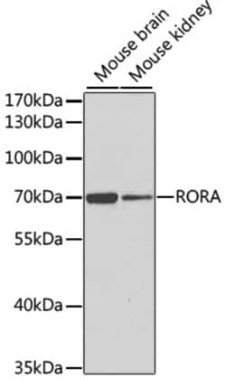 ABclonal Technology RORA Polyclonal Antibody, 100UL, Validated in:WB, IF,