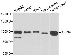 ABclonal Technology ATRIP Polyclonal Antibody, 100UL, Validated in:WB,IP,