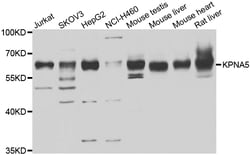 ABclonal Technology KPNA5 Polyclonal Antibody, 100UL, Validated in:WB,
