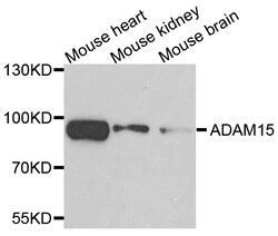 ABclonal Technology ADAM15 Polyclonal Antibody, 100UL, Validated in:WB,