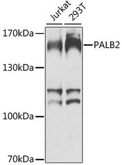 ABclonal Technology PALB2 Polyclonal Antibody, 100UL, Validated in:WB,