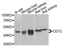 ABclonal Technology CD72 Polyclonal Antibody, 100UL, Validated in:WB, Quantity: