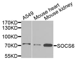 ABclonal Technology SOCS6 Polyclonal Antibody, 100UL, Validated in:WB,