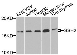 ABclonal Technology SSH2 Polyclonal Antibody, 100UL, Validated in:WB, Quantity:
