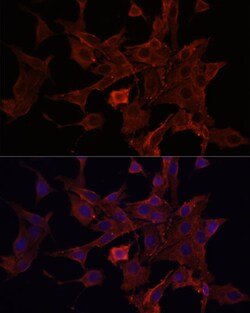 ABclonal Technology ACTB Monoclonal Antibody,100UL,Validated in: WB,IHC,IF,
