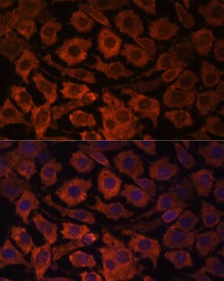 ABclonal Technology ACTB Monoclonal Antibody,100UL,Validated in: WB,IHC,IF,