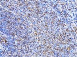 ABclonal Technology ACTB Monoclonal Antibody,100UL,Validated in: WB,IHC,IF,