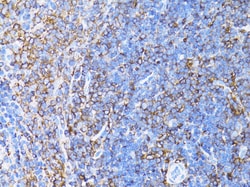 ABclonal Technology ACTB Monoclonal Antibody,100UL,Validated in: WB,IHC,IF,