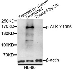 ABclonal Technology Phospho-ALK-Y1096 Polyclonal Antibody, 100UL, Validated