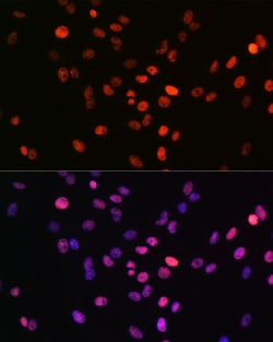ABclonal Technology Phospho-Histone H2AX-S139 Rabbit mAb 100 L, Quantity:
