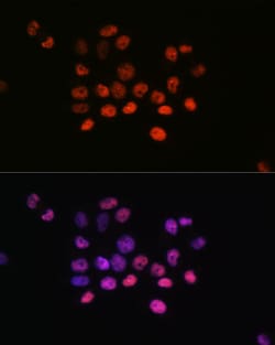 ABclonal Technology Phospho-Histone H2AX-S139 Rabbit mAb 100 L, Quantity:
