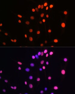 ABclonal Technology Phospho-Histone H2AX-S139 Rabbit mAb 100 L, Quantity:
