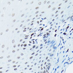 ABclonal Technology Phospho-Histone H2AX-S139 Rabbit mAb 100 L, Quantity: