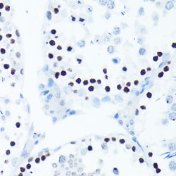 ABclonal Technology Phospho-Histone H2AX-S139 Rabbit mAb 100 L, Quantity: