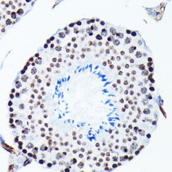 ABclonal Technology Phospho-Histone H2AX-S139 Rabbit mAb 100 L, Quantity: