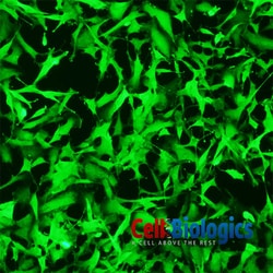 Cell Biologics&nbsp;ADENOCARCINOMA FIBROBLAST-LUNG