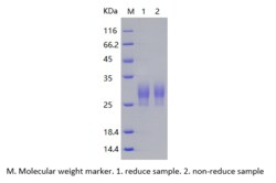 Bon Opus Biosciences Recombinant Human LAIR1 (C-His) -500ug, Quantity: