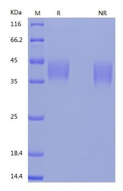 Bon Opus Biosciences Recombinant Human CD200 (C-His) -500ug, Quantity: