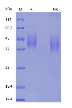 Bon Opus Biosciences Recombinant Human B7-1/CD80 (C-His) -500ug, Quantity: