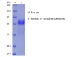 Bon Opus Biosciences Recombinant Human Kallikrein 5/KLK5 (C-His) -500ug,