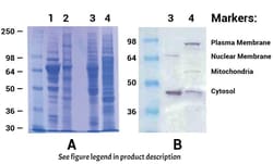 Invent Biotechnologies Inc&nbsp;Minute&trade; Adipose Tissue Fractionation Kit - Spin Column-Based (20 Preps)