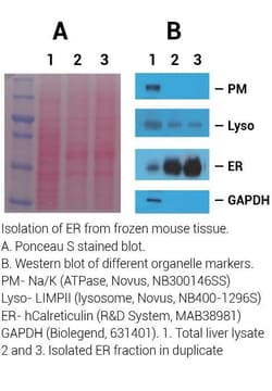 Invent Biotechnologies Inc&nbsp;Minute&trade; High Fidelity ER Isolation Kit for Liver Tissue - spin column-based (20 Preps)