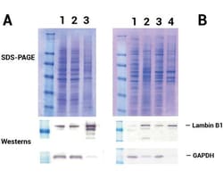 Invent Biotechnologies Inc Minute Nuclear Envelope Protein Extraction Kit
