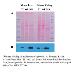 Invent Biotechnologies Inc Minute Detergent-Free Nuclear Matrix Protein