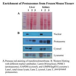 Invent Biotechnologies Inc Minute Cytosolic Proteasome Enrichment Kit -