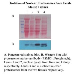 Invent Biotechnologies Inc Minute Nuclear Proteasome Enrichment Kit - Spin