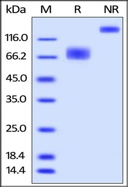 ACROBiosystems ACROBiosystems Biotinylated Human 2B4 / CD244 / SLAMF4 Protein,