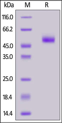 ACROBiosystems ACROBiosystems Human 4-1BB / TNFRSF9 (87-186) Protein, Fc
