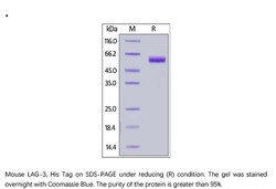 ACROBiosystems Recombinant Protein;Mouse LAG-3 / CD223 Protein;HEK293;100UG;LA3,LAG3,CD223,LAG-3,FDC,