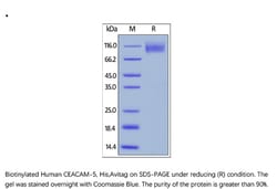 ACROBiosystems Recombinant Protein;Biotinylated Human CEACAM-5 / CD66e