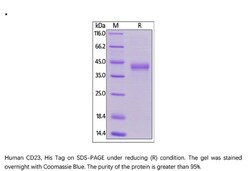 ACROBiosystems Recombinant Protein;Human CD23 / Fc epsilon RII Protein;HEK293;1MG;CD3,FCER2,FCER-2,CD23,CD-23,CD23A,CD-23A,CLEC4J,FCE2,FCE-2,IGEBF,FcεRII,FcεRⅡ,Fcr,Fcgr,Fc
