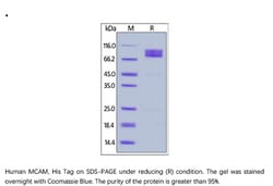 ACROBiosystems Recombinant Protein;Human MCAM / CD146 Protein;HEK293;1MG;CD6,MCAM,CD146,MUC18,