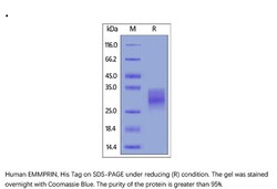 ACROBiosystems Recombinant Protein;Human EMMPRIN / CD147 Protein;HEK293;1MG;CD7,Basigin,BSG,5F7,CD147,EMMPRIN,M6,OK,TCSF,