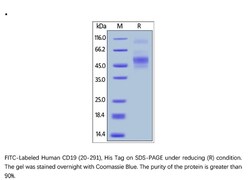 ACROBiosystems Recombinant Protein;FITC-Labeled Human CD19 (20-291) Protein;HEK293;200UG;CD9,CD19,CD-19,B4,B-4,CVID3,CVID-3,MGC12802,