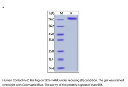 ACROBiosystems Recombinant Protein;Human Contactin-2 / Tag1 / CNTN2 Protein;HEK293;100UG;CN2,CNTN2,CNTN-2,AXT,DKFZp781D102,FLJ37193,FLJ42746,MGC157722,TAG-1,TAG1,TAX,TAX1,TAX-1,Contactin-2,Contactin