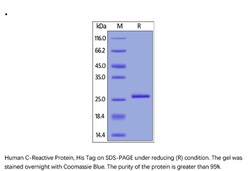 ACROBiosystems Recombinant Protein;Human C-Reactive Protein (CRP) Protein