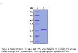 ACROBiosystems Recombinant Protein;Human C-Reactive Protein (CRP) Protein