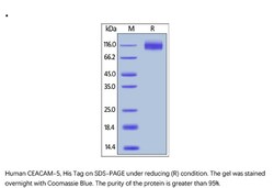 ACROBiosystems Recombinant Protein;Human CEACAM-5 / CD66e Protein;HEK293;1MG;CE5,CEACAM-5,CD66e,CEACAM5,CEA,Meconium